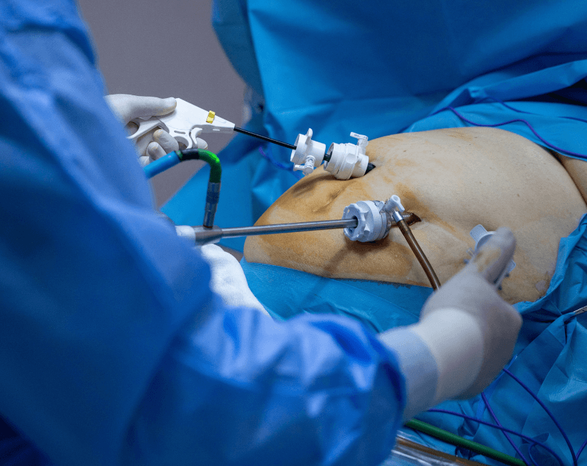 Bariatric Surgery Incisions: What's Normal & What's Not?