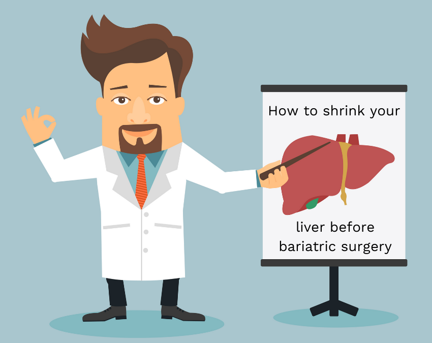 How Can I Tell If My Liver Is Shrinking Before My Bariatric Surgery