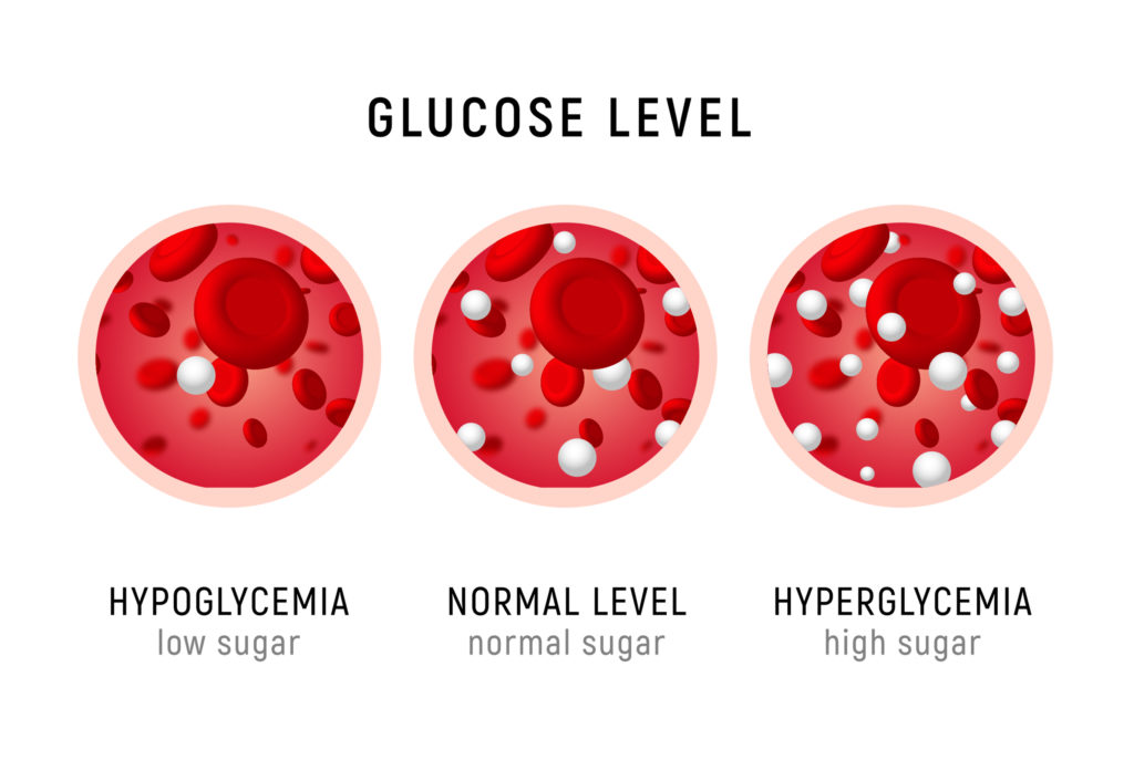 Post-bariatric hypoglycemia image of various levels of blood sugar