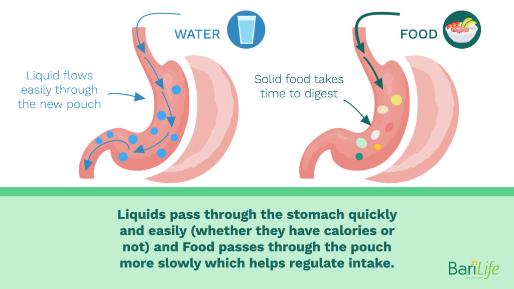 Can Liquids Stretch Your Stomach After Gastric Sleeve Surgery 