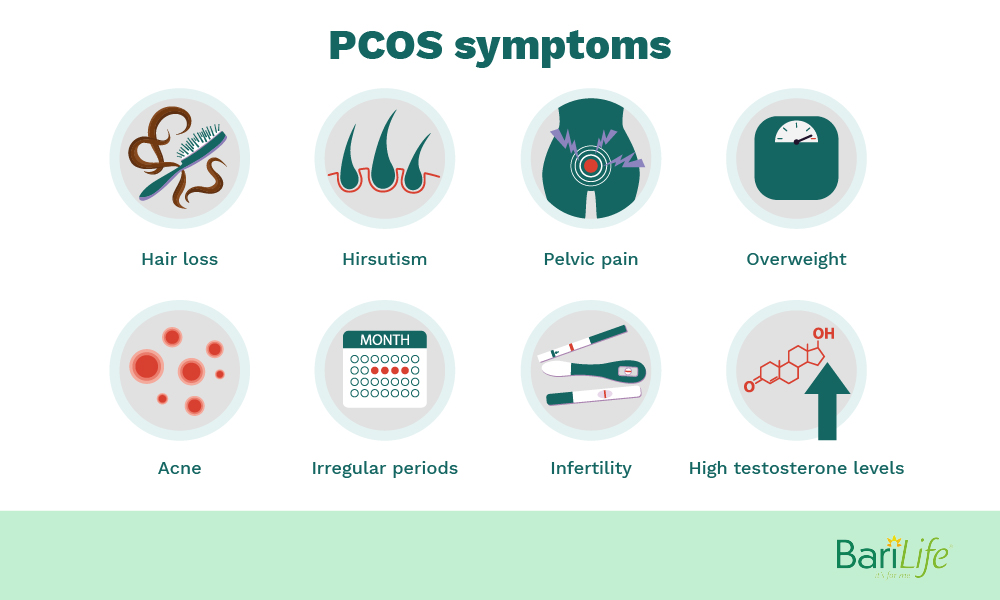 PCOS symptoms for gastric sleeve patients