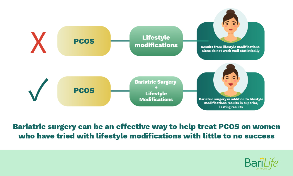 Does gastric sleeve surgery help with PCOS