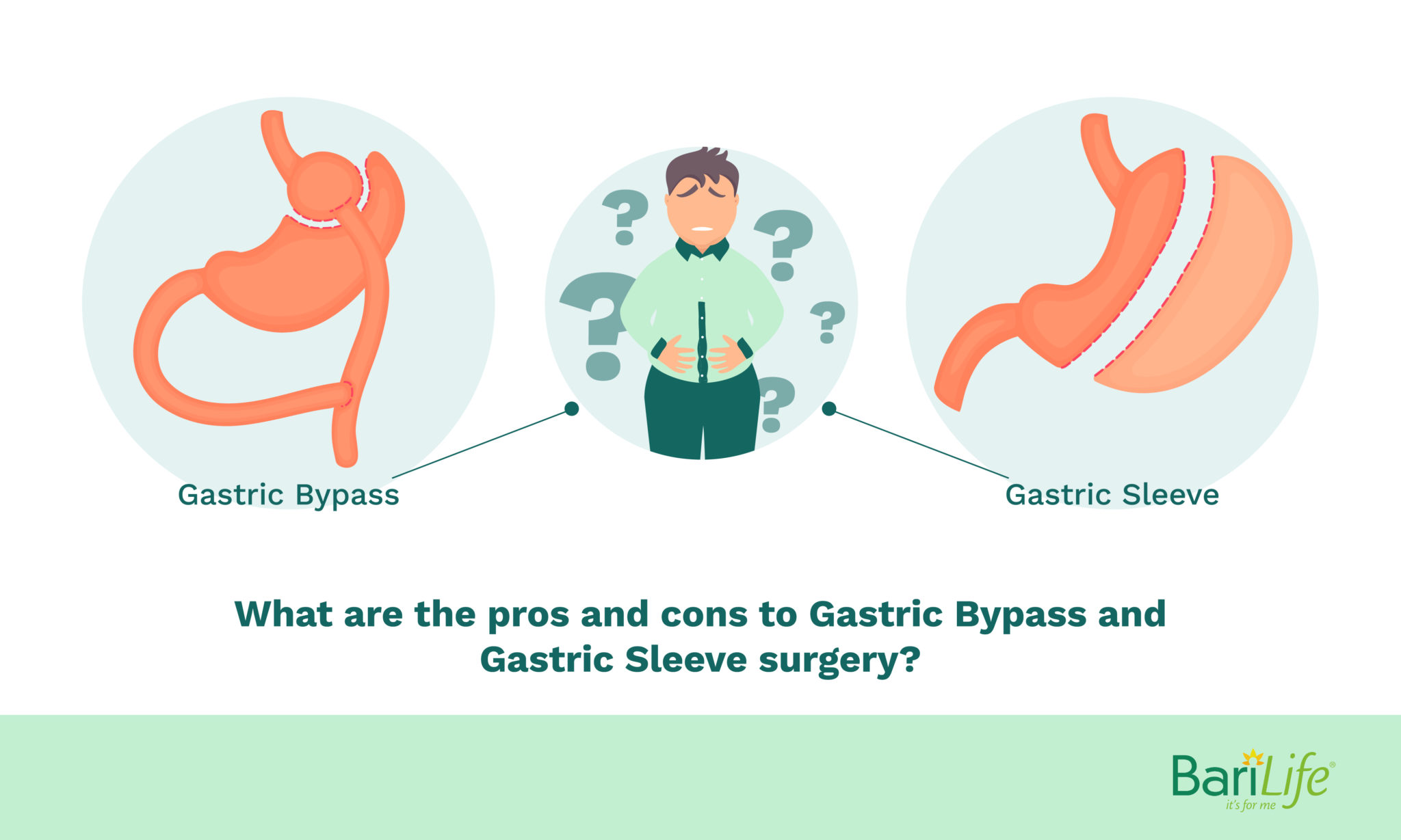 Gastric Sleeve vs. Gastric Bypass: What are the Pros and Cons?