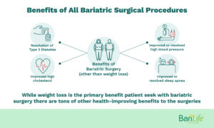 Gastric Sleeve vs. Gastric Bypass: What are the Pros and Cons?