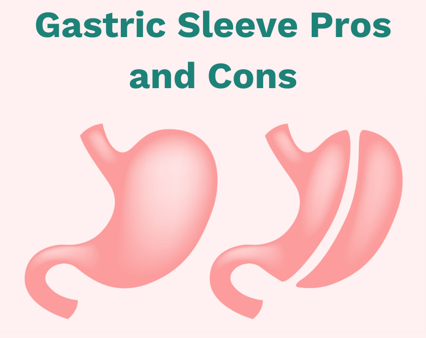 Gastric Sleeve Vs Gastric Bypass Differences Pros Con 