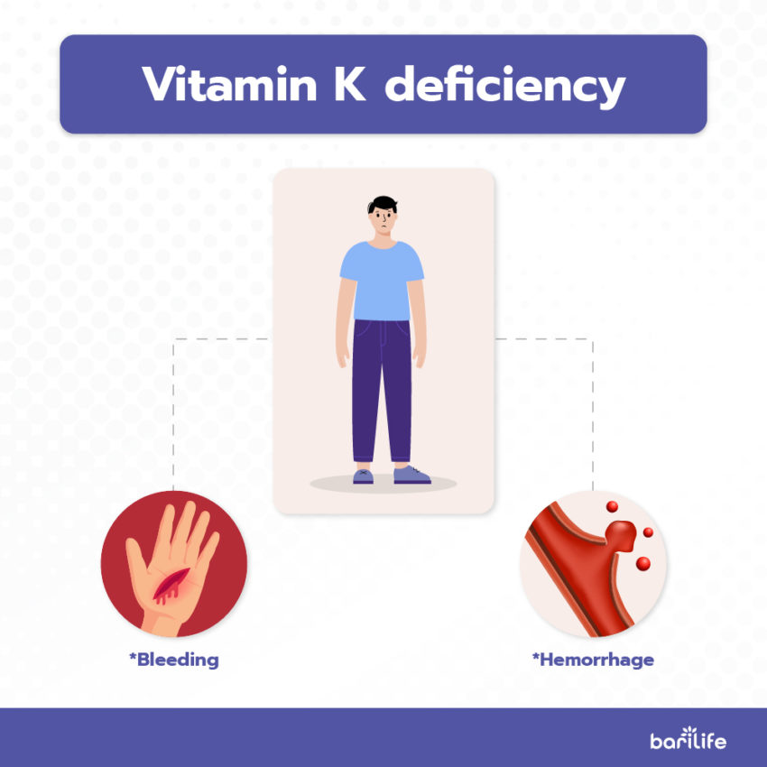 Vitamin K Everything to know about Vitamin K after bariatric surgery