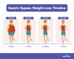 Gastric bypass weight loss chart