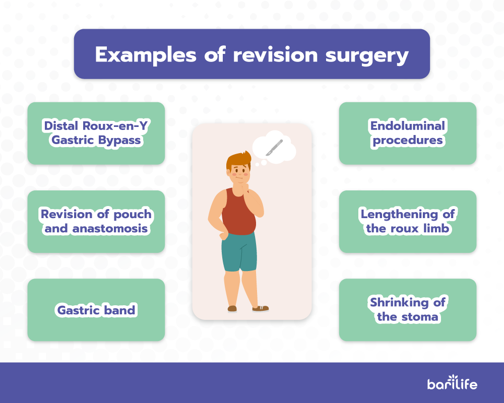 Examples of revision surgery after gastric bypass