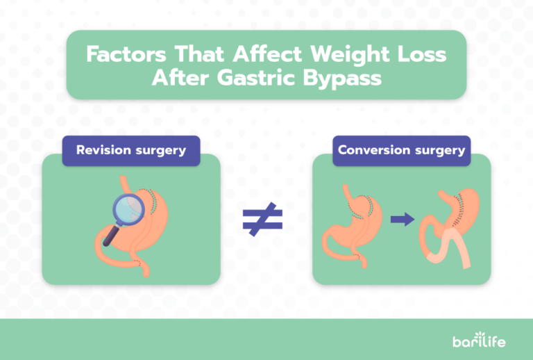 Gastric Bypass Revision Surgery: Everything You Need To Know