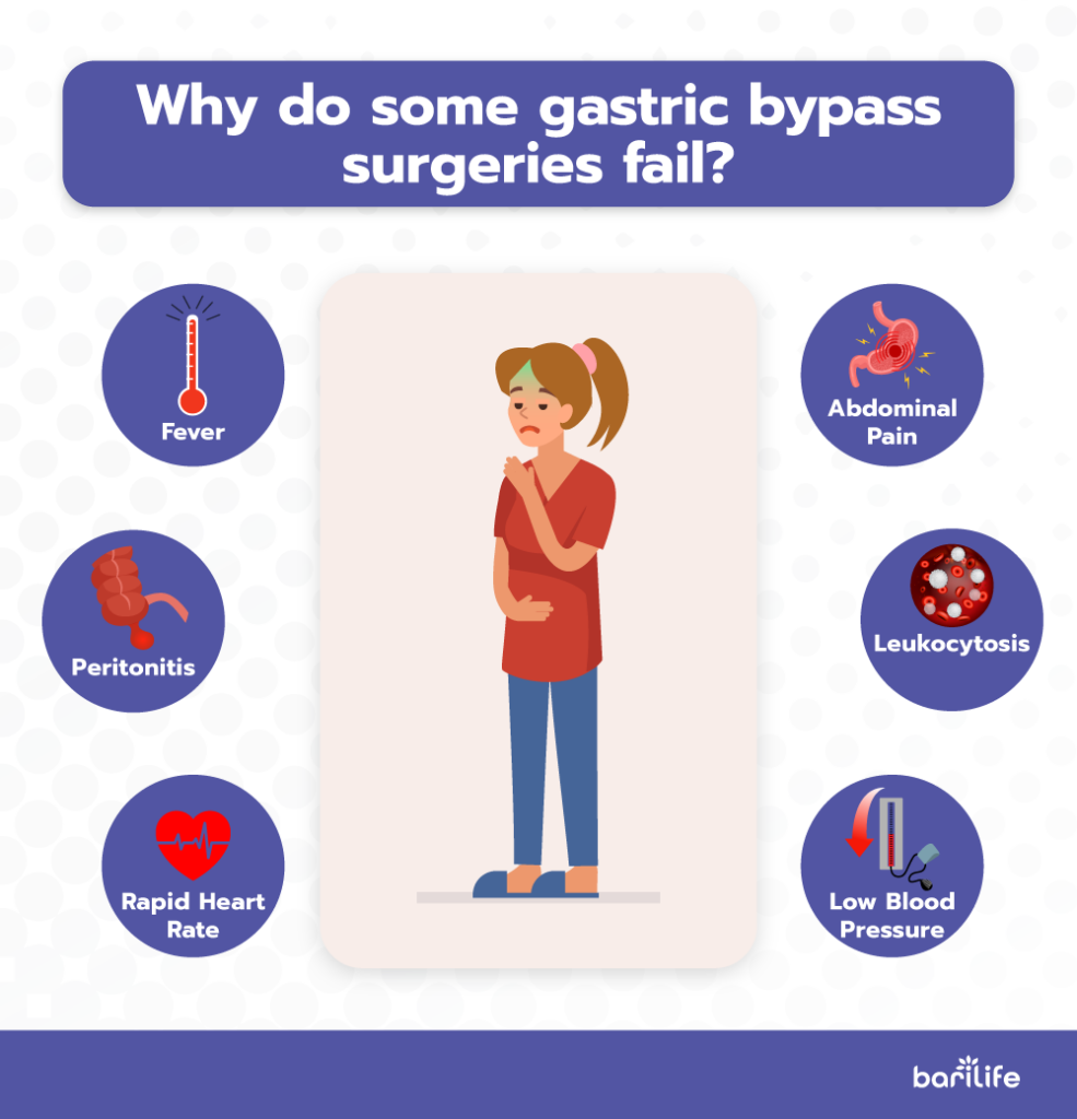 Why do some gastric bypass surgeries fail