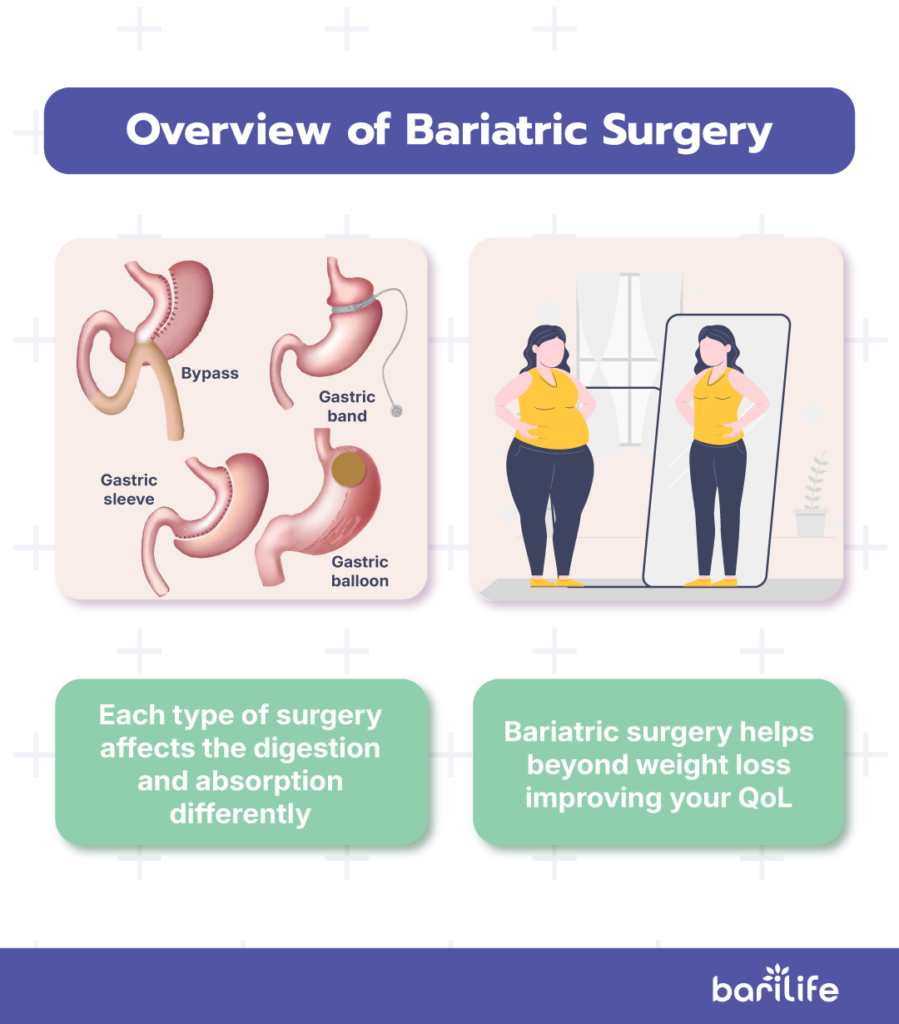 restrictive vs malabsorptive bariatric surgery