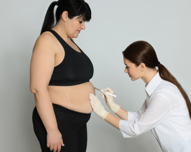 Reversible Bariatric Surgery: A Game-Changer for Weight Loss